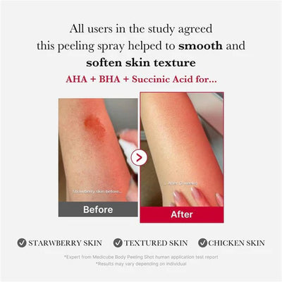 Medicube Red Acne Succinic Acid Peel 40 Grams.