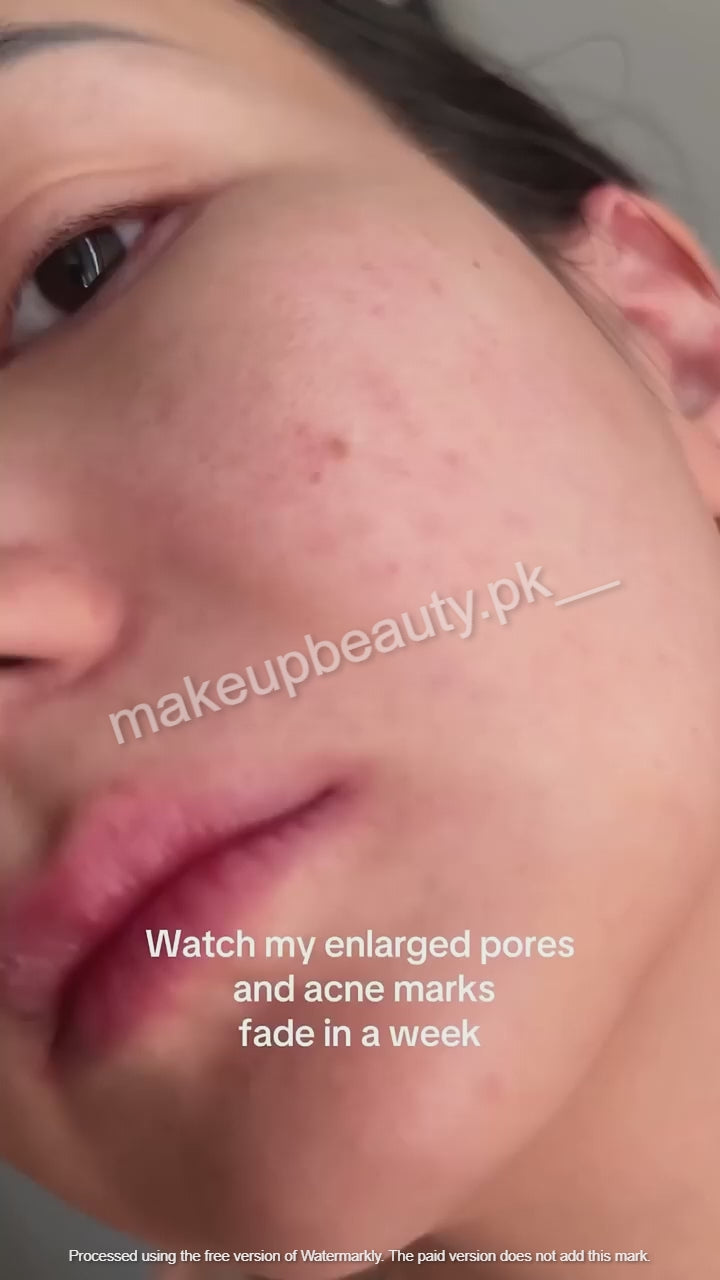 Anua Niacinamide 10% + TXA 4% Dark spot Serum. (New and Latest Packaging). 30 ML