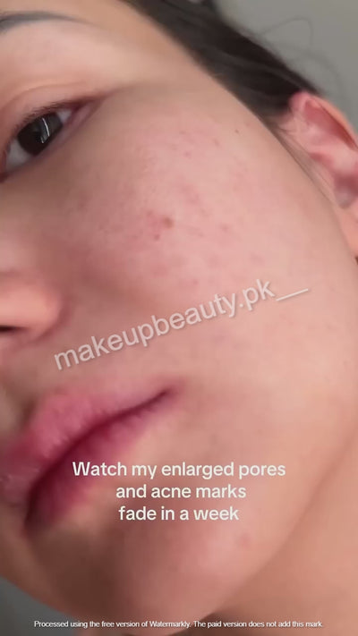 Anua Niacinamide 10% + TXA 4% Dark spot Serum. (New and Latest Packaging). 30 ML