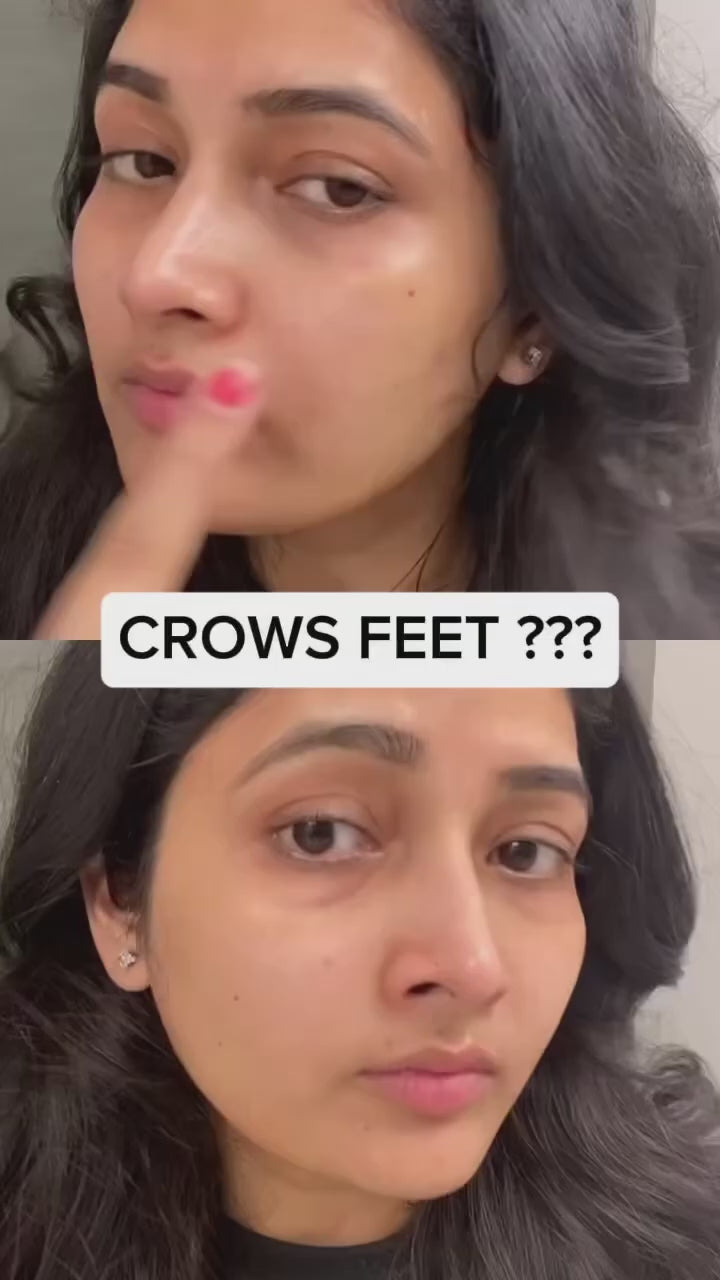 Skin 1004 Pro bio Cica Bakuchiol Eye cream 20 ML.